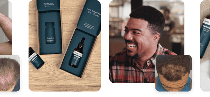 Happy Head Coupon – Up To 60% Off First Month of  Personalized Hair Regrowth Treatments!